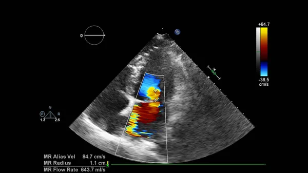Ultrasound Monitor